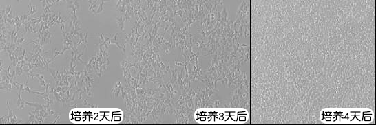 HEK293T細(xì)胞培養(yǎng)過(guò)程中的不同密度情況